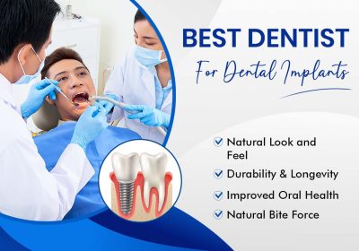 best-dentist-for-dental-implants