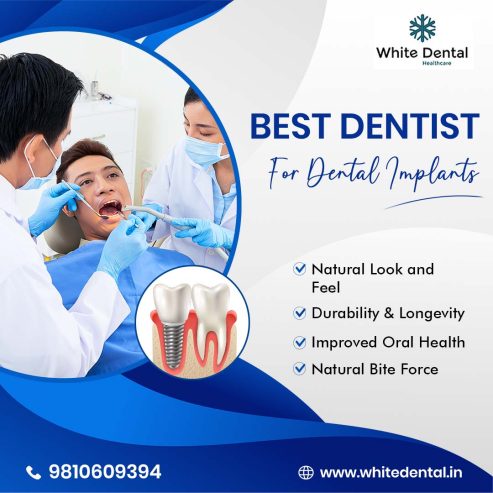 Find the Best Dentist for Dental Implants Near You