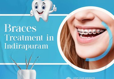 braces-treatment-in-Indirapuram